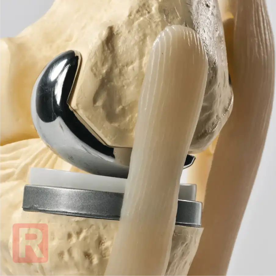 Szyna CPM po endoprotezie Elbląg