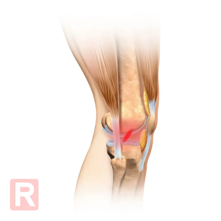 Wynajem szyny CPM Elbląg